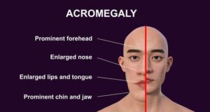 In Honor of Black History Month, Healthy Heritage is Celebrating Families with the Launch of the Effective Black Parenting Program A stuntman knew his body was changing. It took doctors nearly a decade to figure out why.