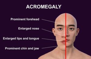 In Honor of Black History Month, Healthy Heritage is Celebrating Families with the Launch of the Effective Black Parenting Program A stuntman knew his body was changing. It took doctors nearly a decade to figure out why.